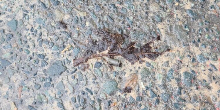 Hire car driver hospitalized after being shot in the buttock.