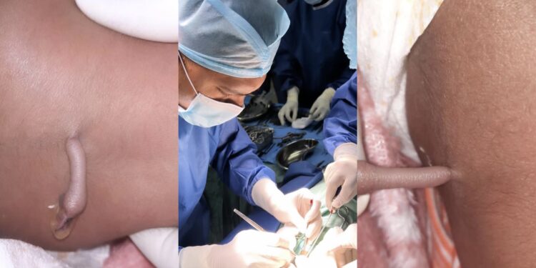 Baby born with tail.