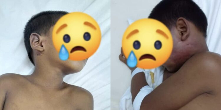 Police looking for Parika man who brutalized four-year-old son