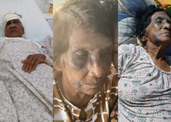 Pensioner allegedly beaten by relative.